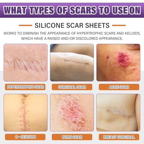 Medical-Grade Silicone Scar Tape for Effective Scar Treatment