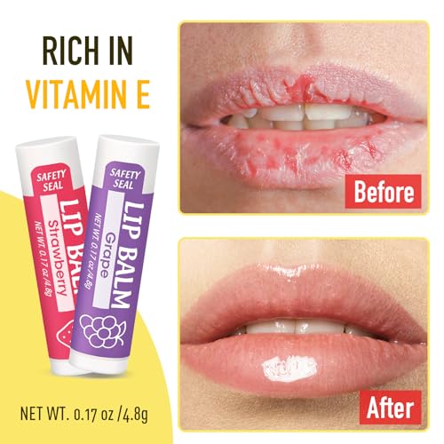 YesBes 16 Pack Natural Lip Balm with Vitamin E & Coconut Oil