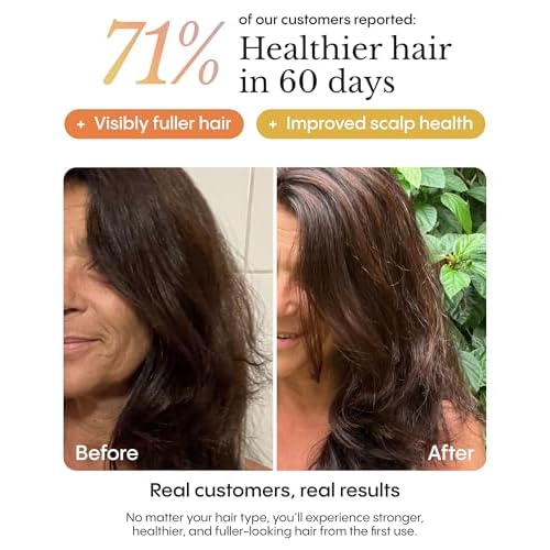 Fr©ªya Organics The Complete System For Mature Hair & Scalp | Scalp Balance and Fuller Looking Hair | Rosemary Pumpkin Seed Turmeric Calendula | Botanical Formula | 60 Day Supply