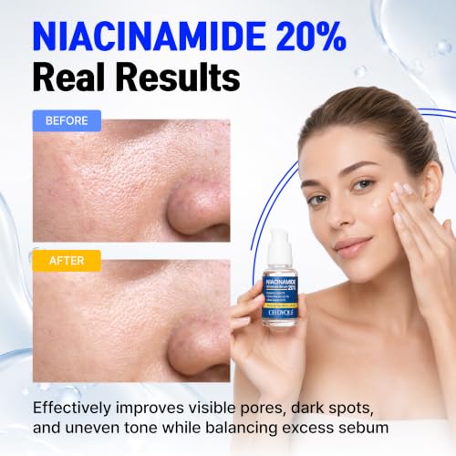 Niacinamide 20% + Hyaluronic Acid Serum 1 Fl Oz - Pore Minimizer & Skin Tone Evener