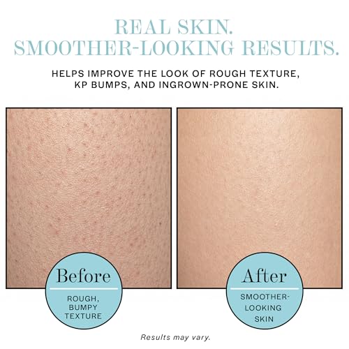 BASE LABORATORIES Ingrown Hair & KP Exfoliating Scrub with AHA & BHA