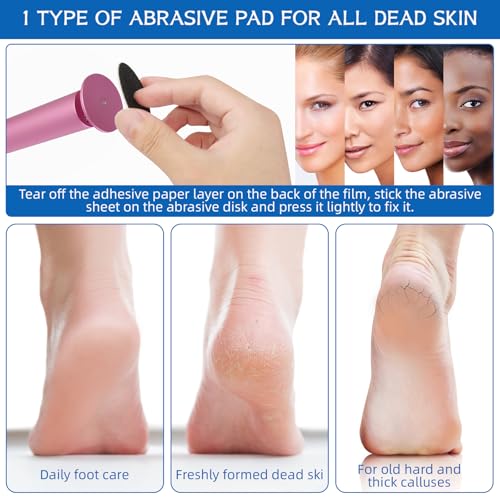 Electric Foot Callus Remover with 60 Sandpaper Discs & Speed Control – Pedicure Grinder for Men & Women