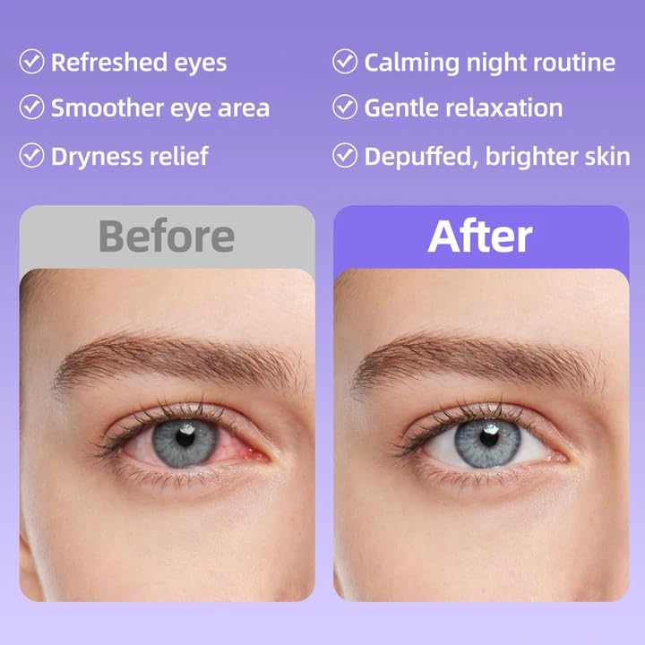 CHAOYA Self-Heating Steam Eye Mask - 16 Disposable Masks for Dry Eyes & Puffiness Relief