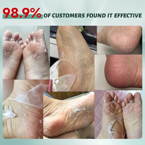 VGO Foot Peeling Mask - Natural Exfoliating Callus Remover (3 Pack)
