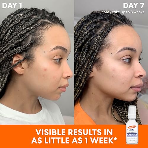 Palmer's Skin Success Tone Correcting Face Serum with Vitamin E - 1 Oz