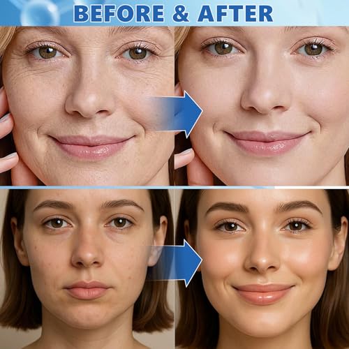 ABOTE Collagen Sheet Mask for Glass Skin, Firming & Hydration - 4 Pack