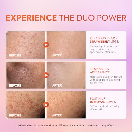 DERMA E Microdermabrasion Scrub with Dead Sea Salt & Citrus Essential Oils ? Facial Exfoliating Scrub Smooths, Revitalizes and Renews ? Ideal for Scars and Wrinkles, 2oz