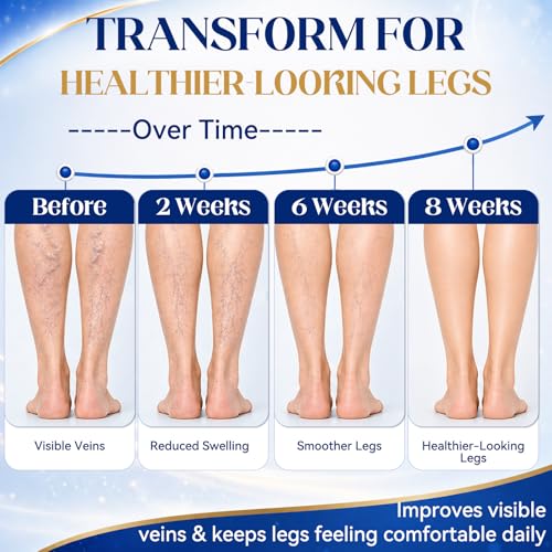 JOYAONE Varicose Veins Cream for Fast Relief & Circulation - 150g