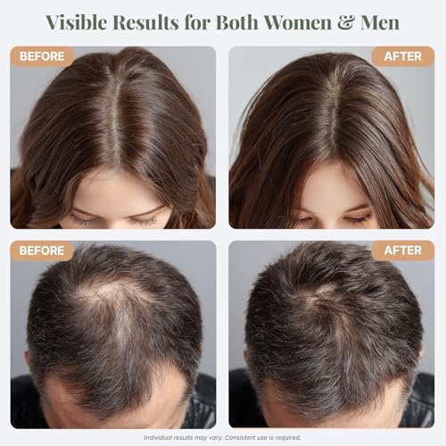 Organic Rosemary Oil for Hair Growth - 4oz Nourishing Formula