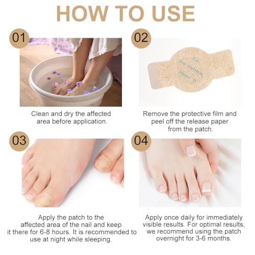 Toenail Repair Patches - 30 Hydrogel Nail Treatment for Damage