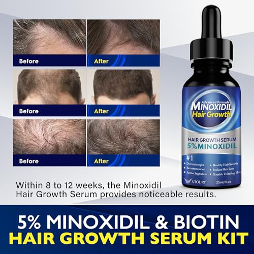 Minoxidil Hair Growth Serum for Men & Women with Biotin - Thicker Hair & Beard Enhancement