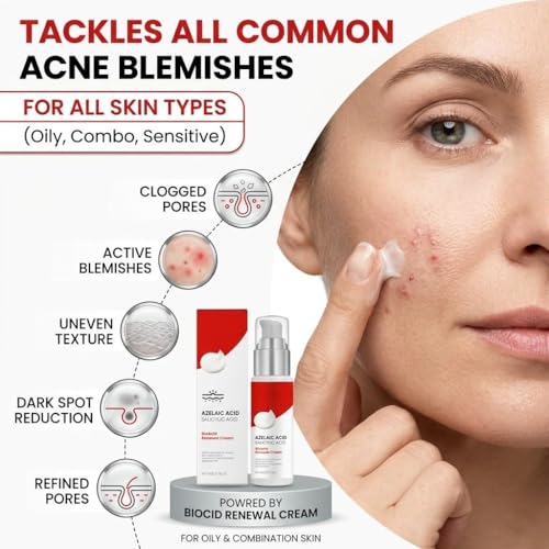 Yeardera 10% Azelaic Acid Acne Spot Treatment Cream - Soothing Moisturizer for Sensitive Skin, 1.6 oz
