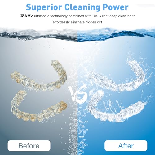Etegow Ultrasonic Retainer Cleaner Machine - 200ML Portable & Quiet