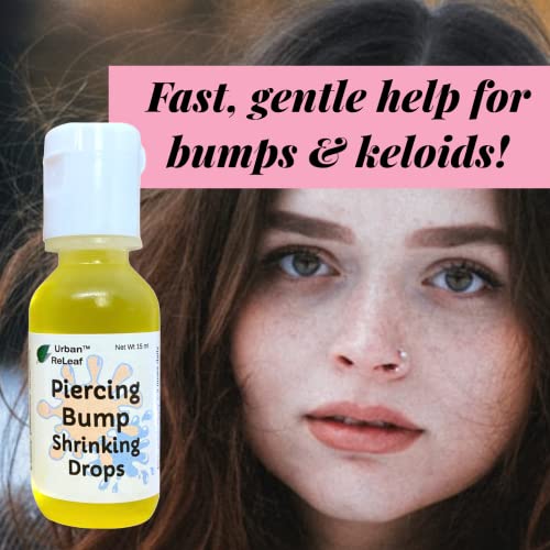 Urban ReLeaf Piercing Bump Shrinking Drops - Natural Aftercare for Scars & Nodules