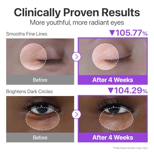 numbuzin No.9 NAD+ Retinol Eye Cream, Depuffing & Firming Eye Serum for Dark Circles, Wrinkles & Fine Lines, Peptides & Niacinamide for Glow & for Plumping Care, 0.33 fl oz