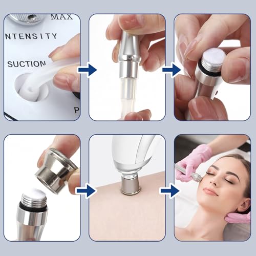 Mcwdoit 4 Pack Diamond Dermabrasion Heads for Microdermabrasion Home Facial Tool