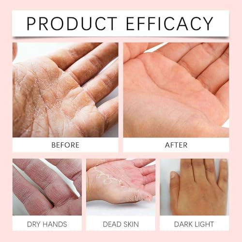 Retinol Hand Cream Anti-Aging 50g with Collagen - Daily Moisturizer & Cuticle Care (1 Fl Oz)