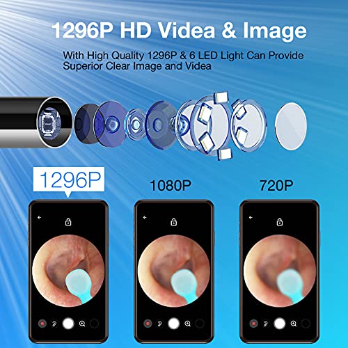 Wireless Ear Wax Removal Camera Kit 1296P HD with 6 Ear Tools & LED Lights