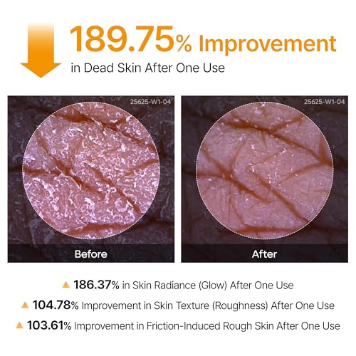 Dr.Melaxin Peel Shot Kojic Acid Turmeric Body Exfoliator Spray 6.76 fl.oz - AHA PHA Niacinamide Body Scrub for KP Bumps, Dark Spots, Uneven Skin Tone, Dead Skin, Korean Skin Care