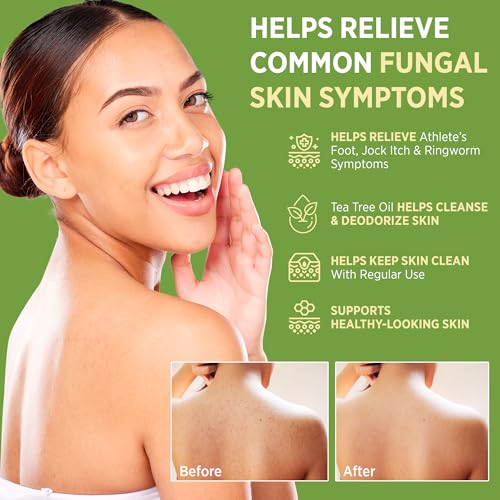 Roycederm Antifungal Bar Soap with Tea Tree Oil - 4 Ounce Pack of 2 for Athlete’s Foot, Jock Itch & Ringworm Treatment
