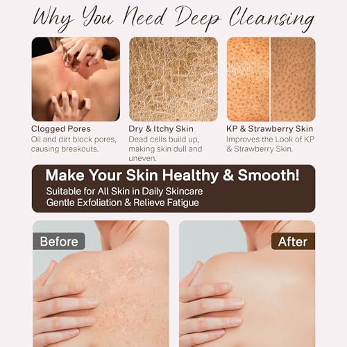 Korean Exfoliating Gloves - 2 Pcs Body Scrub Mitts for Dead Skin