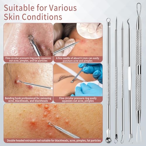 Blackhead Remover Tool Kit - 12 Piece Pimple Popper & Tweezers Set