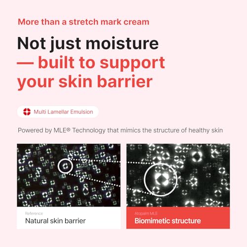 ATOPALM Maternity Care Stretch Mark Cream, 150ml 5 Fl Oz, Canola Oil Postpartum Skin Care| Pregnancy Red Lines Relief | Skin Swelling Elasticity Improvement| Gentle Body Moisturizing | Kbeauty