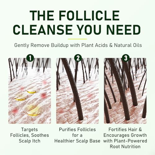 Follicle Shampoo 10.14 Fl Oz - Anti-Dandruff for Itchy Scalp Relief