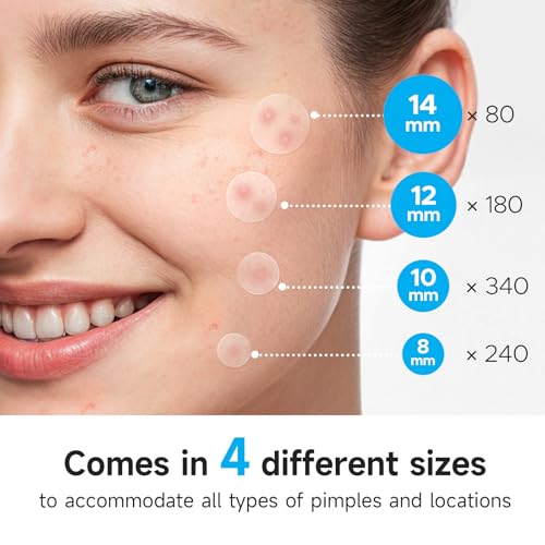 Glowpatch Pimple Patches - 840 Hydrocolloid Zit Stickers in 4 Sizes