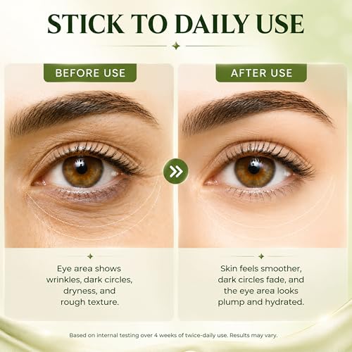 ZIIDII Retinol Eye Cream with PDRN & Peptides - 1.06 fl oz Anti-Aging Under Eye Treatment