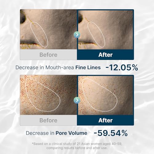 ROOTIO Vegan Collagen Deep Hydrating Sleeping Mask 4 Pack – Pore Minimize & Firm
