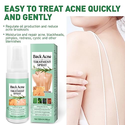 BEFIVECOK 2PCS Back Acne Spray Treatment with Herbal Formula, Salicylic Acid & Tea Tree Oil