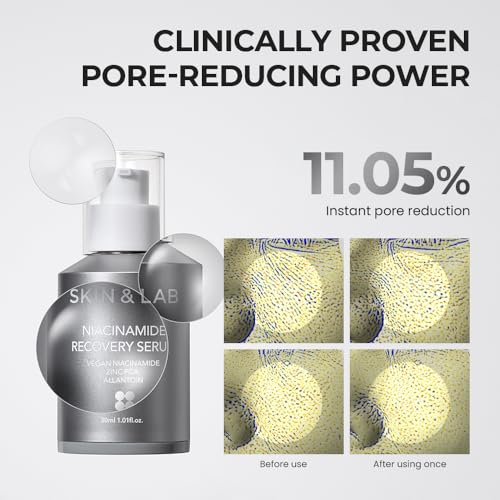 SKIN&LAB Niacinamide Recovery Serum 20% - Minimize Pores & Improve Texture