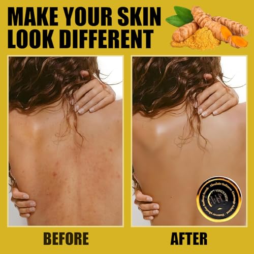 VINGT-NEUF Original Exfoliating Turmeric Body Scrub 280g Brightening & Dark Spot Treatment
