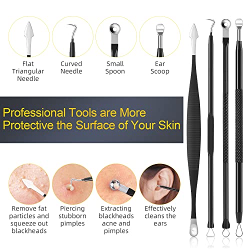 15-Piece Professional Stainless Steel Pimple Popper and Blackhead Remover Kit