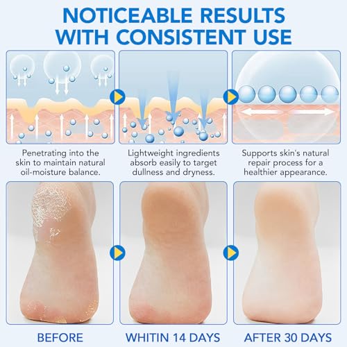 WeiWeiLa Urea 60% & Salicylic Acid Foot Care Stick 2-Pack, Callus Remover for Cracked Heels & Dry Skin