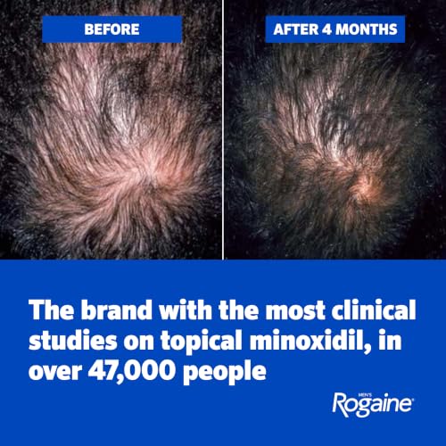 Men's Rogaine Extra Strength 5% Minoxidil Solution, 3 Mo Supply, 3x 2 Fl Oz
