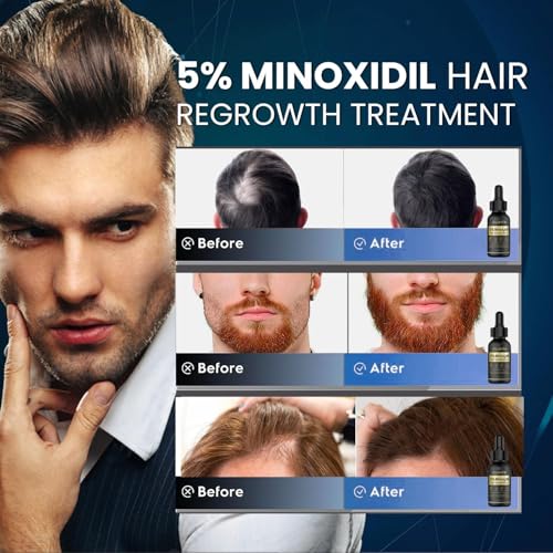 Olivita 5% Minoxidil Hair Growth Serum for Men & Women - 2 fl oz