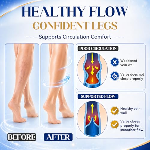 JOYAONE Varicose Veins Cream for Fast Relief & Circulation - 150g