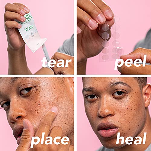 Mario Badescu Invisible Blemish Patches - 60 Vegan Spot Treatments