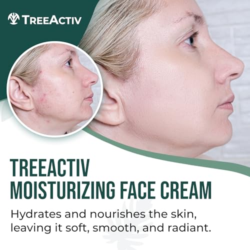 TreeActiv Acne Cream with 2% Salicylic Acid, Oil-Control Face Moisturizer
