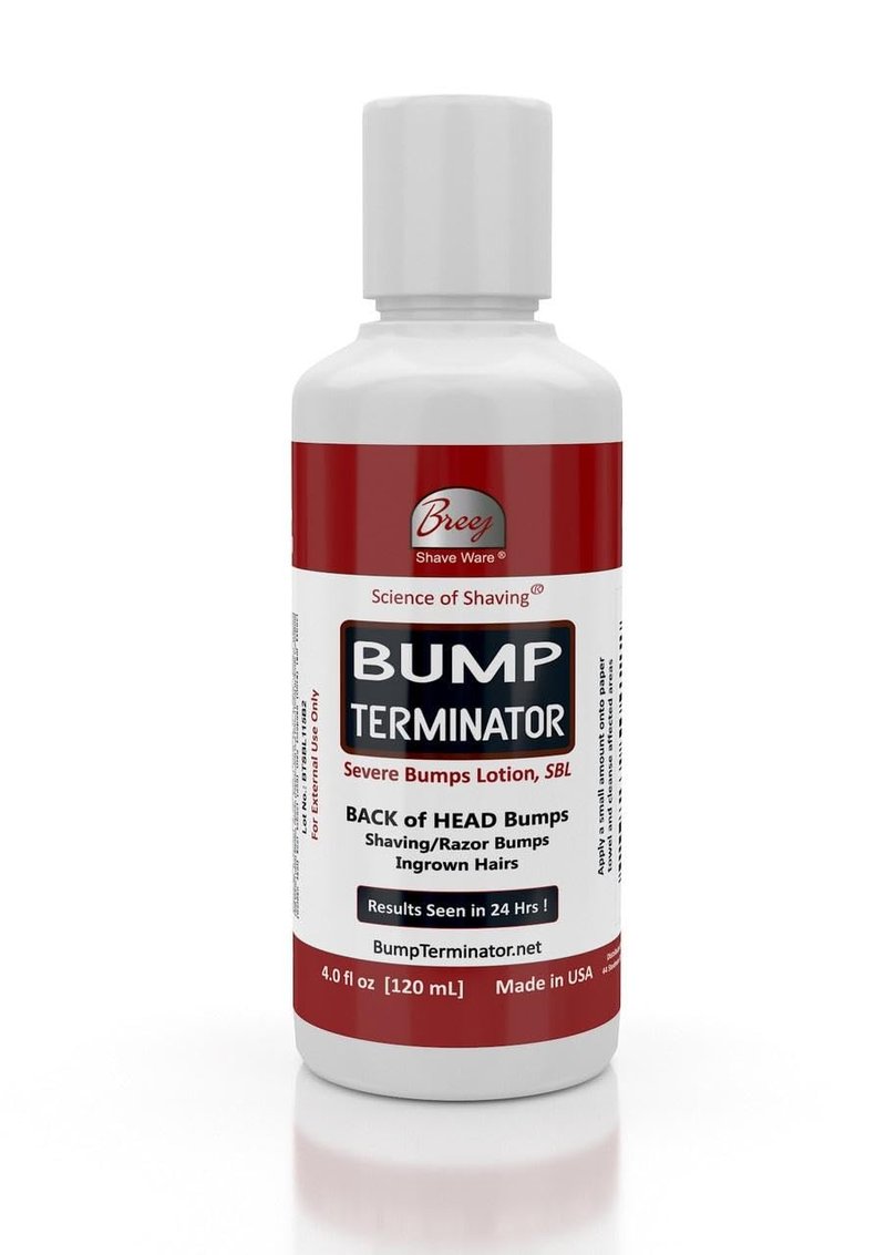 BREEJ BUMP TERMINATOR Severe Bumps Treatment | Razor Bumps And Ingrown Hair Treatment | Bikini Bumps | Back of Head Bumps And Ingrown Hair Treatment, 4 oz (Pack of 1)