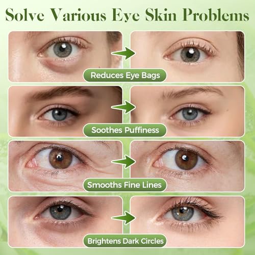 Nexkayee Aloe Vera Under Eye Patches for Dark Circles & Puffiness