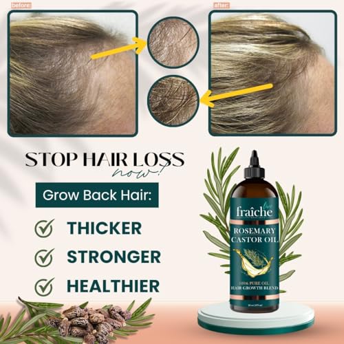 Live Fraiche Rosemary Castor Oil for Hair Growth - 16 Fl Oz, Pack of 1