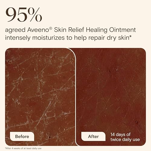 Aveeno Skin Relief Healing Ointment for Dry, Cracked Skin - 7.2 oz