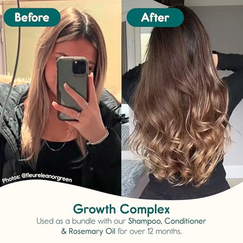 Nature Spell Hair Growth Shampoo - Sulfate Free for Strength & Shine, 10.14 fl oz