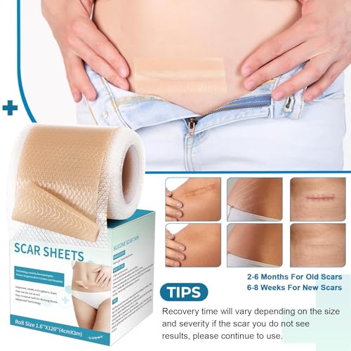Rvlaim 3M Medical-Grade Silicone Scar Tape 1.6”x120” Reusable Sheets