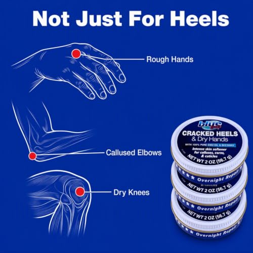 Blue Goo Cracked Heels & Dry Hands Skin Protectant - 2 oz (Pack of 2)