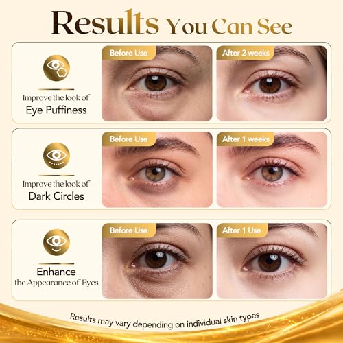 80 PCS Gold Collagen Eye Patches for Dark Circles & Puffiness