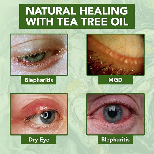 NOVEHA Tea Tree Oil Eye Cream for Wrinkles & Dry Skin - 1.69 Fl Oz